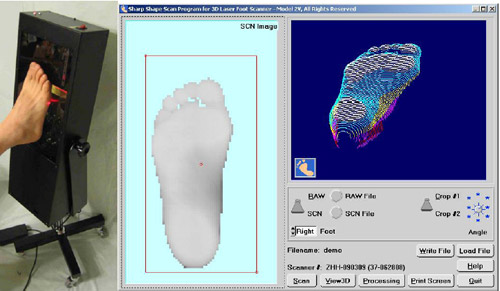 3D Laser Scanner